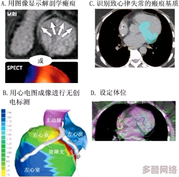 红桃ct：最新研究揭示其在心血管健康中的潜在影响与应用前景，值得关注的科学发现与临床意义